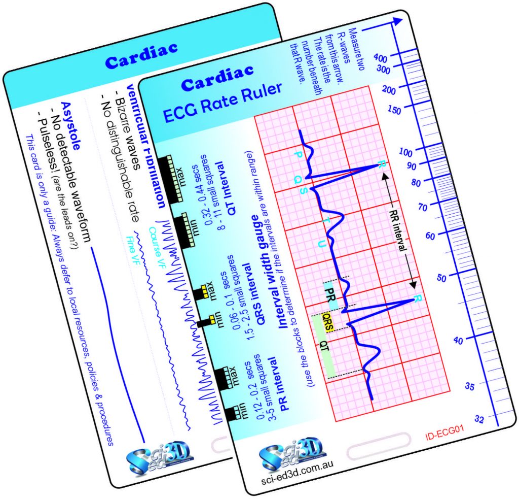 Ref Card: Cardiac - ECG 1 Rate Ruler / Important Rhythms - Sciencopia